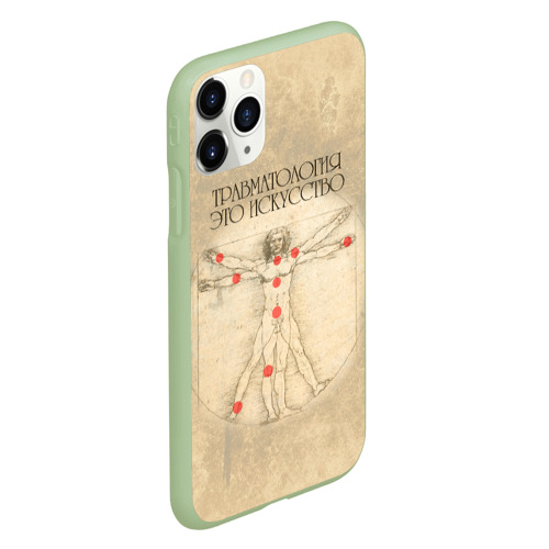 Чехол для iPhone 11 Pro матовый с принтом Травматология это искусство, вид сбоку #3